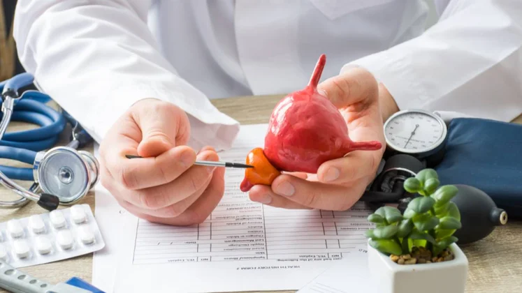Médico sosteniendo una próstata de plástico.